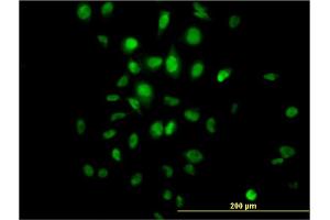 Immunofluorescence of monoclonal antibody to HDAC3 on HeLa cell. (HDAC3 抗体  (AA 319-428))