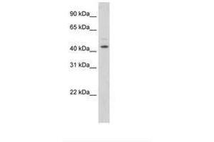 Image no. 2 for anti-Tumor Susceptibility Gene 101 (TSG101) (AA 121-170) antibody (ABIN202410) (TSG101 抗体  (AA 121-170))