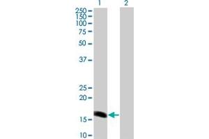 Western Blot analysis of BARX1 expression in transfected 293T cell line by BARX1 monoclonal antibody (M01A), clone 1E7. (BARX1 抗体  (AA 1-100))