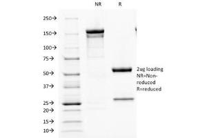 SDS-PAGE Analysis of Purified, BSA-Free Parathyroid Hormone Antibody (clone PTH/1173). (PTH 抗体  (AA 32-115))