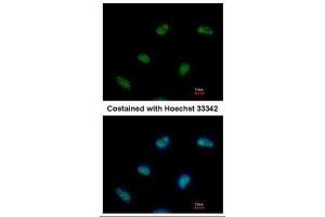ICC/IF Image Immunofluorescence analysis of paraformaldehyde-fixed HeLa, using Rad9, antibody at 1:500 dilution. (RAD9A 抗体  (Center))