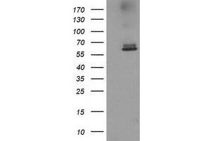 HEK293T cells were transfected with the pCMV6-ENTRY control (Left lane) or pCMV6-ENTRY ACOT12 (Right lane) cDNA for 48 hrs and lysed. (ACOT12 抗体)