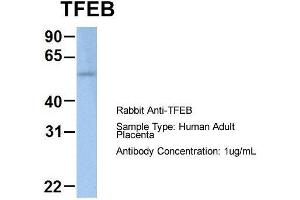 Host: Rabbit  Target Name: TFEB  Sample Tissue: Human Adult Placenta  Antibody Dilution: 1.