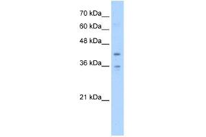 TMEM104 antibody used at 5 ug/ml to detect target protein. (TMEM104 抗体  (Middle Region))