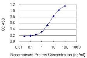 Detection limit for recombinant GST tagged SIX2 is 0. (SIX2 抗体  (AA 1-291))