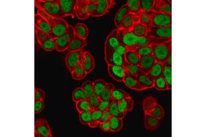 Immunofluorescence Analysis of PFA-fixed MCF-7 cells labeled withFOXA1 Monoclonal Antibody (FOXA1/1518)followed by goat anti- mouse IgG-CF488. (FOXA1 抗体  (AA 372-472))