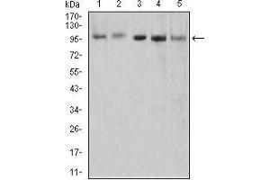 Western blot analysis using XRN2 mouse mAb against HEK293 (1), NTERA-2 (2), LNcap (3), HepG2 (4), and PC-3 (5) cell lysate. (XRN2 抗体  (AA 398-547))