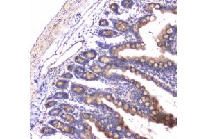 IHC testing of FFPE rat small intestine tissue with RAB27A antibody at 1ug/ml. (RAB27A 抗体)