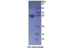 SDS-PAGE analysis of Mouse KATNA1 Protein.