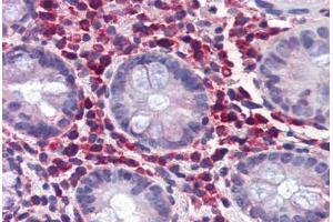 Human Colon (formalin-fixed, paraffin-embedded) stained with TRIM21 antibody ABIN337310 at 5 ug/ml followed by biotinylated anti-goat IgG secondary antibody ABIN481715, alkaline phosphatase-streptavidin and chromogen. (TRIM21 抗体  (AA 386-398))