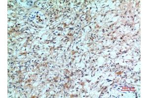 Immunohistochemistry (IHC) analysis of paraffin-embedded Human Brain, antibody was diluted at 1:100. (CXCR2 抗体  (N-Term))
