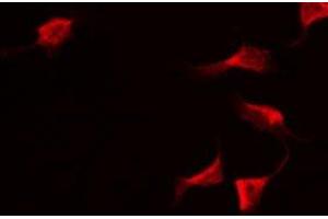 Immunofluorescence (fixed cells) (IF/ICC) image for anti-serpin Peptidase Inhibitor, Clade A (Alpha-1 Antiproteinase, Antitrypsin), Member 5 (SERPINA5) (Internal Region) antibody (ABIN6258641)