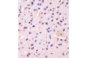 Immunohistochemistry (Paraffin-embedded Sections) (IHC (p)) image for anti-Proliferating Cell Nuclear Antigen (PCNA) (AA 236-261), (C-Term) antibody (ABIN1882273)