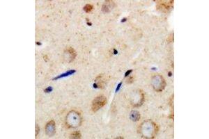 Immunohistochemical analysis of GAB1 staining in human brain formalin fixed paraffin embedded tissue section. (GAB1 抗体  (C-Term))