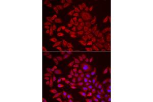 Immunofluorescence analysis of HeLa cells using  antibody (ABIN6129825, ABIN6136640, ABIN6136641 and ABIN6222174). (AGPAT2 抗体  (AA 199-278))