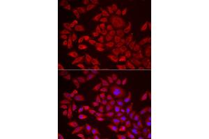 Immunofluorescence analysis of HeLa cells using  antibody (ABIN6129825, ABIN6136640, ABIN6136641 and ABIN6222174). (AGPAT2 抗体  (AA 199-278))