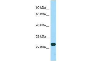 Host: Rabbit Target Name: CCDC59 Sample Type: HepG2 Whole Cell lysates Antibody Dilution: 1. (CCDC59 抗体  (C-Term))