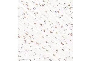 Immunohistochemistry of paraffin embedded rat heart using ADI1 (ABIN7072888) at dilution of 1:1600 (300x lens) (ADI1 抗体)