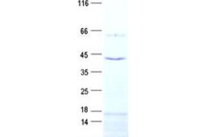 Western Blotting (WB) image for Solute Carrier Family 25, Member 28 (SLC25A28) protein (His tag) (ABIN2732160)