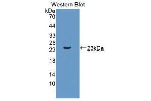 Western blot analysis of recombinant Mouse IL11. (IL-11 抗体  (AA 25-199))