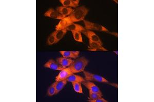 Immunofluorescence analysis of NIH-3T3 cells using RPS19 Rabbit mAb (ABIN1681275, ABIN3017969, ABIN3017970 and ABIN7101552) at dilution of 1:100 (40x lens). (RPS19 抗体)