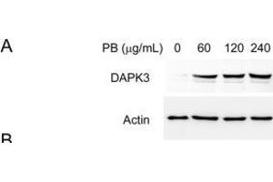PB triggered cell apoptosis involves elevation of reactive oxygen species (ROS) and accumulation of ER stress. (DAPK3 抗体  (N-Term))