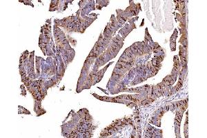 IHC analysis of Geminin/GMNN using anti-Geminin/GMNN antibody (ABIN7600598). (Geminin 抗体  (AA 21-196))