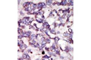 Immunohistochemistry (Paraffin-embedded Sections) (IHC (p)) image for anti-Pyruvate Dehydrogenase Kinase, Isozyme 2 (PDK2) (C-Term) antibody (ABIN359096)
