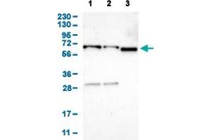 Western Blot analysis of (1) human cell line RT-4 (2) human cell line U-251MG sp, and (3) human plasma (IgG/HSA depleted). (EIF2AK1 抗体  (AA 34-180))