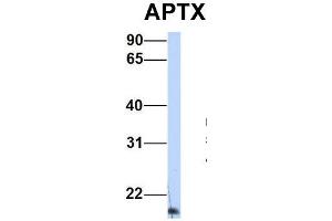 Host:  Rabbit  Target Name:  APTX  Sample Type:  Human HepG2  Antibody Dilution:  1. (Aprataxin 抗体  (Middle Region))
