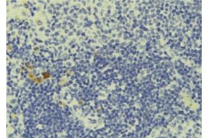 ABIN6277704 at 1/100 staining Human lymph tissue by IHC-P. (PCM1 抗体  (N-Term))