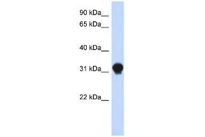 WB Suggested Anti-DNALI1 Antibody Titration: 0. (DNALI1 抗体  (N-Term))