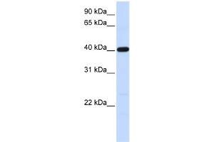 WB Suggested Anti-TMOD3 Antibody Titration: 0. (TMOD3 抗体  (N-Term))