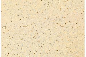 ABIN6265962 and ABIN6269219 at 1/100 staining Mouse brain tissue by IHC-P.