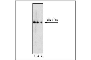 Western blot analysis of RORgammat expression by mouse thymocytes. (ROR gamma T/RORC2/NR1F3 抗体)