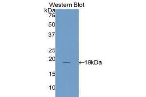 Western blot analysis of the recombinant protein. (IL1RN 抗体  (AA 26-177))