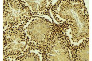 ABIN6274520 at 1/100 staining Mouse testis tissue by IHC-P. (AKIP1 抗体  (Internal Region))