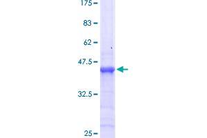 HOXB13 Protein (AA 61-216) (GST tag)