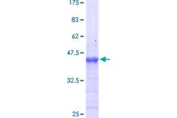 HOXB13 Protein (AA 61-216) (GST tag)