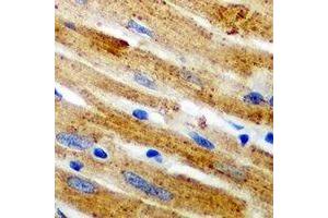 Immunohistochemical analysis of Calpain 1 staining in mouse heart formalin fixed paraffin embedded tissue section.