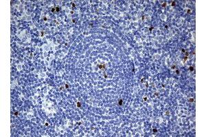 Image no. 7 for anti-Antigen Identified By Monoclonal Antibody Ki-67 (MKI67) (AA 1160-1493) antibody (ABIN1490857) (Ki-67 抗体  (AA 1160-1493))