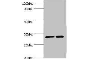 Western blot All lanes: SLC25A15 antibody at 6 μg/mL Lane 1: Mouse liver tissue Lane 2: Mouse stomach tissue Secondary Goat polyclonal to rabbit IgG at 1/10000 dilution Predicted band size: 33 kDa Observed band size: 33 kDa (SLC25A15 抗体  (AA 1-301))