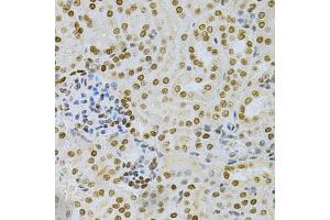 Immunohistochemistry of paraffin-embedded mouse kidney using DKC1 Antibody (ABIN5970956) at dilution of 1/200 (40x lens). (DKC1 抗体)