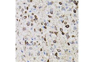 Immunohistochemistry of paraffin-embedded mouse brain using MMP9 antibody (ABIN7268426) at dilution of 1:100 (40x lens). (MMP 9 抗体  (AA 400-500))
