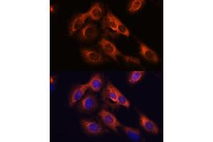 Immunofluorescence analysis of C6 cells using R antibody (ABIN7269856) at dilution of 1:100. (RAPH1 抗体  (AA 1-240))