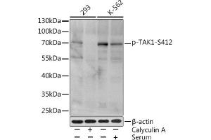 Western blot analysis of extracts of various cell lines, using Phospho-T-S412 Rabbit pAb (ABIN3019511, ABIN3019512, ABIN3019513 and ABIN6225441) at 1:1000 dilution. (MAP3K7 抗体  (pSer412))