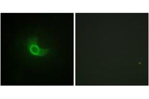 Immunofluorescence analysis of NIH-3T3 cells, using CD130/gp130 (Ab-782) Antibody. (CD130/gp130 抗体  (AA 748-797))