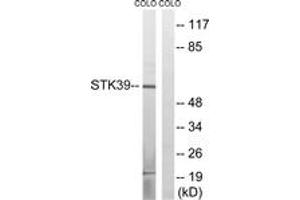Western blot analysis of extracts from COLO cells, using STK39 (Ab-311) Antibody. (STK39 抗体  (AA 277-326))