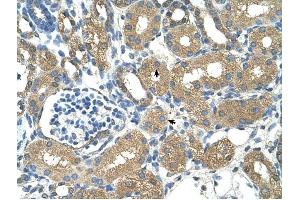 ADH4 antibody was used for immunohistochemistry at a concentration of 4-8 ug/ml to stain Epithelial cells of renal tubule (arrows) in Human Kidney. (ADH4 抗体)