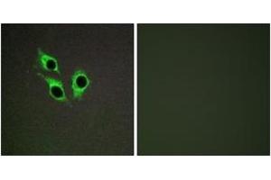 Immunofluorescence analysis of HepG2 cells, using TM16J Antibody. (ANO9 抗体  (AA 481-530))